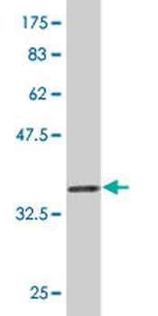 NDOR1 monoclonal antibody (M01), clone 3A11