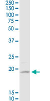 D4S234E monoclonal antibody (M01), clone 1C3