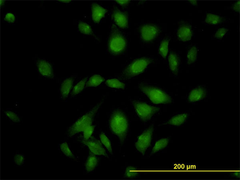 ATP2C1 monoclonal antibody (M01), clone 2G1