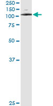 ATP2C1 monoclonal antibody (M01), clone 2G1