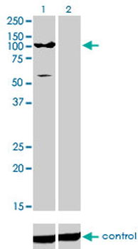 ATP2C1 monoclonal antibody (M01), clone 2G1