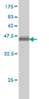 ATP2C1 monoclonal antibody (M01), clone 2G1