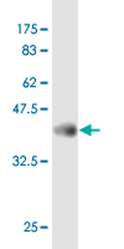 GREM1 monoclonal antibody (M07), clone 2D1