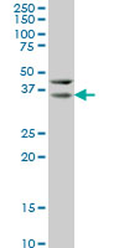 HEYL monoclonal antibody (M07), clone 1F6