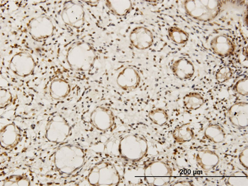 HEYL monoclonal antibody (M07), clone 1F6