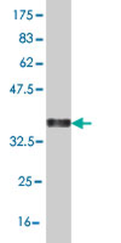 HEYL monoclonal antibody (M07), clone 1F6