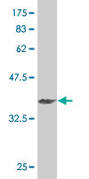 HEYL monoclonal antibody (M03), clone 2G1