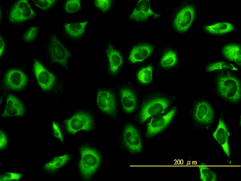 SERBP1 monoclonal antibody (M01), clone 1D2-2E9