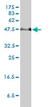 SERBP1 monoclonal antibody (M01), clone 1D2-2E9