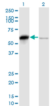 SERBP1 monoclonal antibody (M01), clone 1D2-2E9