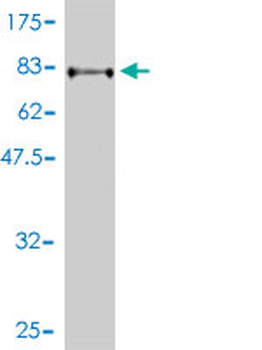 SERBP1 monoclonal antibody (M01), clone 1D2-2E9
