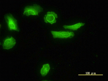 LDLRAP1 monoclonal antibody (M01), clone 4G4-D5