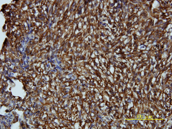 LDLRAP1 monoclonal antibody (M01), clone 4G4-D5