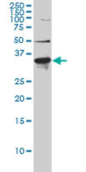 LDLRAP1 monoclonal antibody (M01), clone 4G4-D5