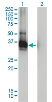 LDLRAP1 monoclonal antibody (M01), clone 4G4-D5
