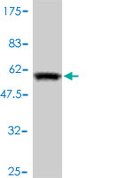 LDLRAP1 monoclonal antibody (M01), clone 4G4-D5