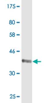 DFNB31 monoclonal antibody (M05), clone 2D12