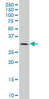 BRMS1 monoclonal antibody (M01), clone 2D4-2G11