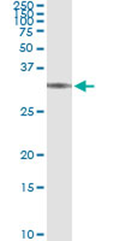 BRMS1 monoclonal antibody (M01), clone 2D4-2G11