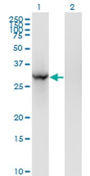 BRMS1 monoclonal antibody (M01), clone 2D4-2G11