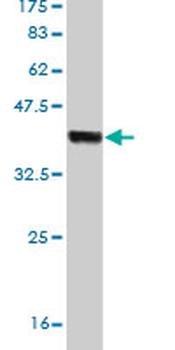 HECTD1 monoclonal antibody (M03), clone 1E10