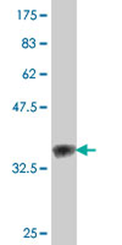 PRDX5 polyclonal antibody (A01)