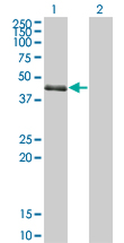 SPDEF monoclonal antibody (M01), clone 4A5