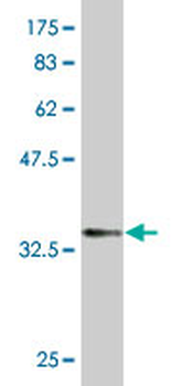 SPDEF monoclonal antibody (M01), clone 4A5