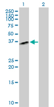 QPCT purified MaxPab rabbit polyclonal antibody (D01P)