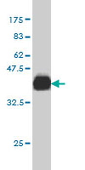 PRKD3 monoclonal antibody (M01), clone 4G7