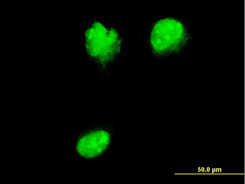 NUP62 monoclonal antibody (M02), clone 2D3