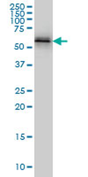 NUP62 monoclonal antibody (M02), clone 2D3