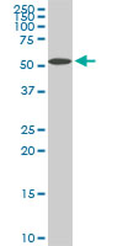 NUP62 monoclonal antibody (M02), clone 2D3
