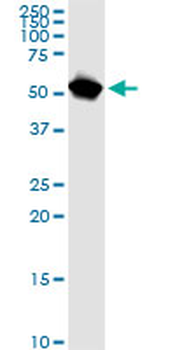 NUP62 monoclonal antibody (M02), clone 2D3