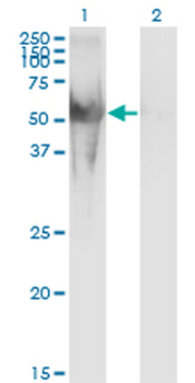 NUP62 monoclonal antibody (M02), clone 2D3