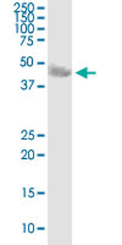 CA14 purified MaxPab mouse polyclonal antibody (B01P)