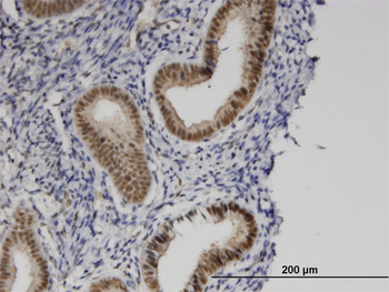 ZMYND8 monoclonal antibody (M01), clone 5B12