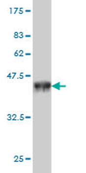 ZMYND8 monoclonal antibody (M01), clone 5B12