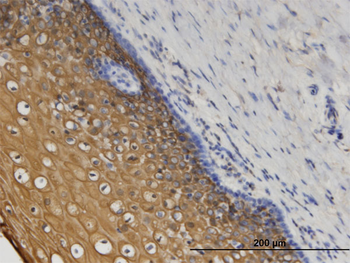 CORO1C monoclonal antibody (M02), clone 1F7