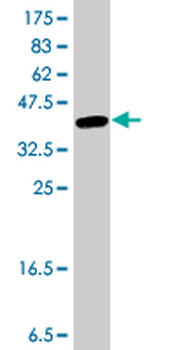 CORO1C polyclonal antibody (A01)