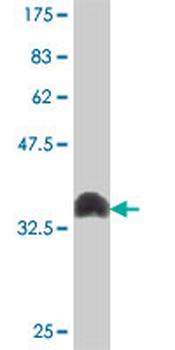 SMUG1 polyclonal antibody (A01)