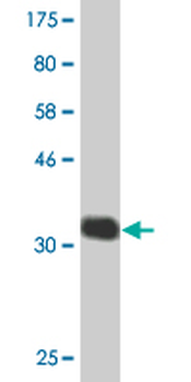 CHST5 monoclonal antibody (M05), clone 2E6