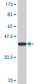ATP6V0A2 polyclonal antibody (A01)