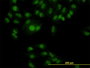 RBM9 monoclonal antibody (M01), clone 4G3