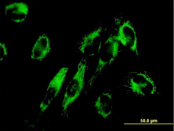 NNT monoclonal antibody (M01), clone 1D6