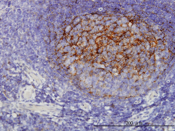 QPRT monoclonal antibody (M01), clone 5D11