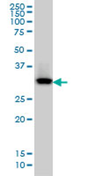 QPRT monoclonal antibody (M01), clone 5D11