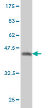 QPRT monoclonal antibody (M01), clone 5D11