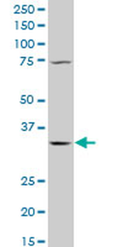 QPRT polyclonal antibody (A01)