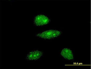 HEY1 monoclonal antibody (M01), clone 3B3